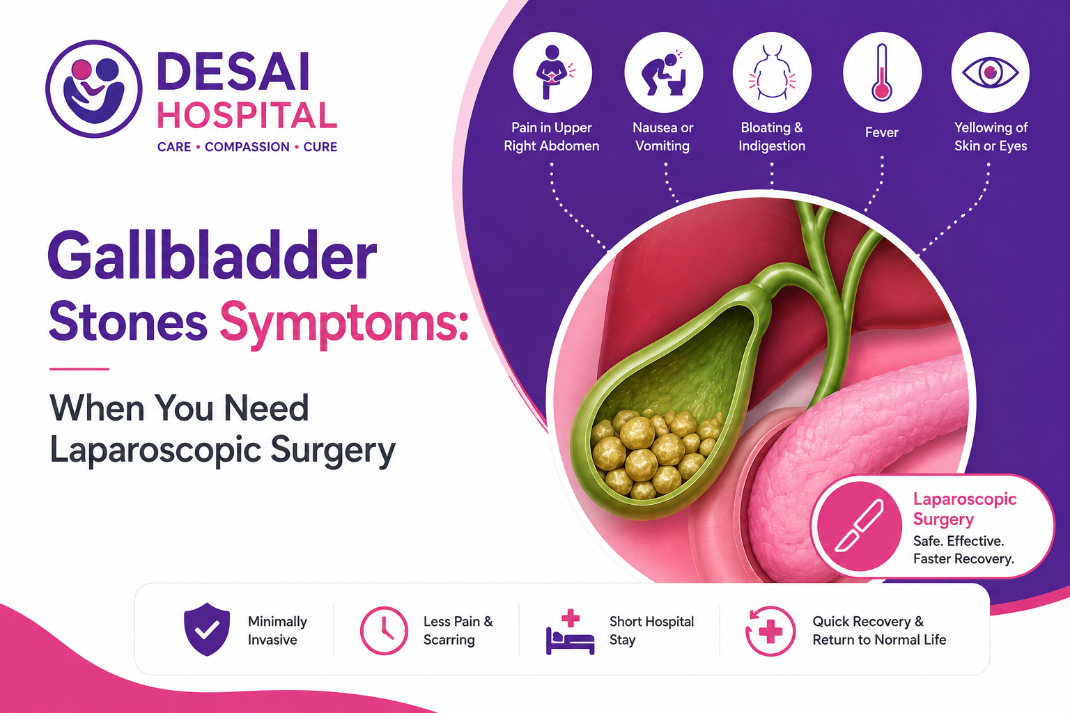 Gallbladder Stone