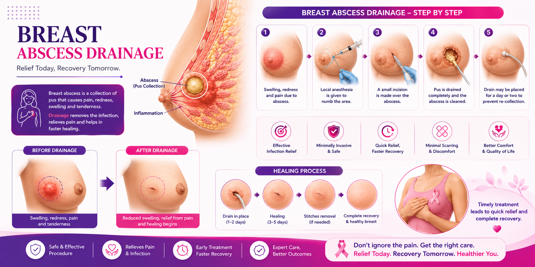 Breast Abscess Drainage