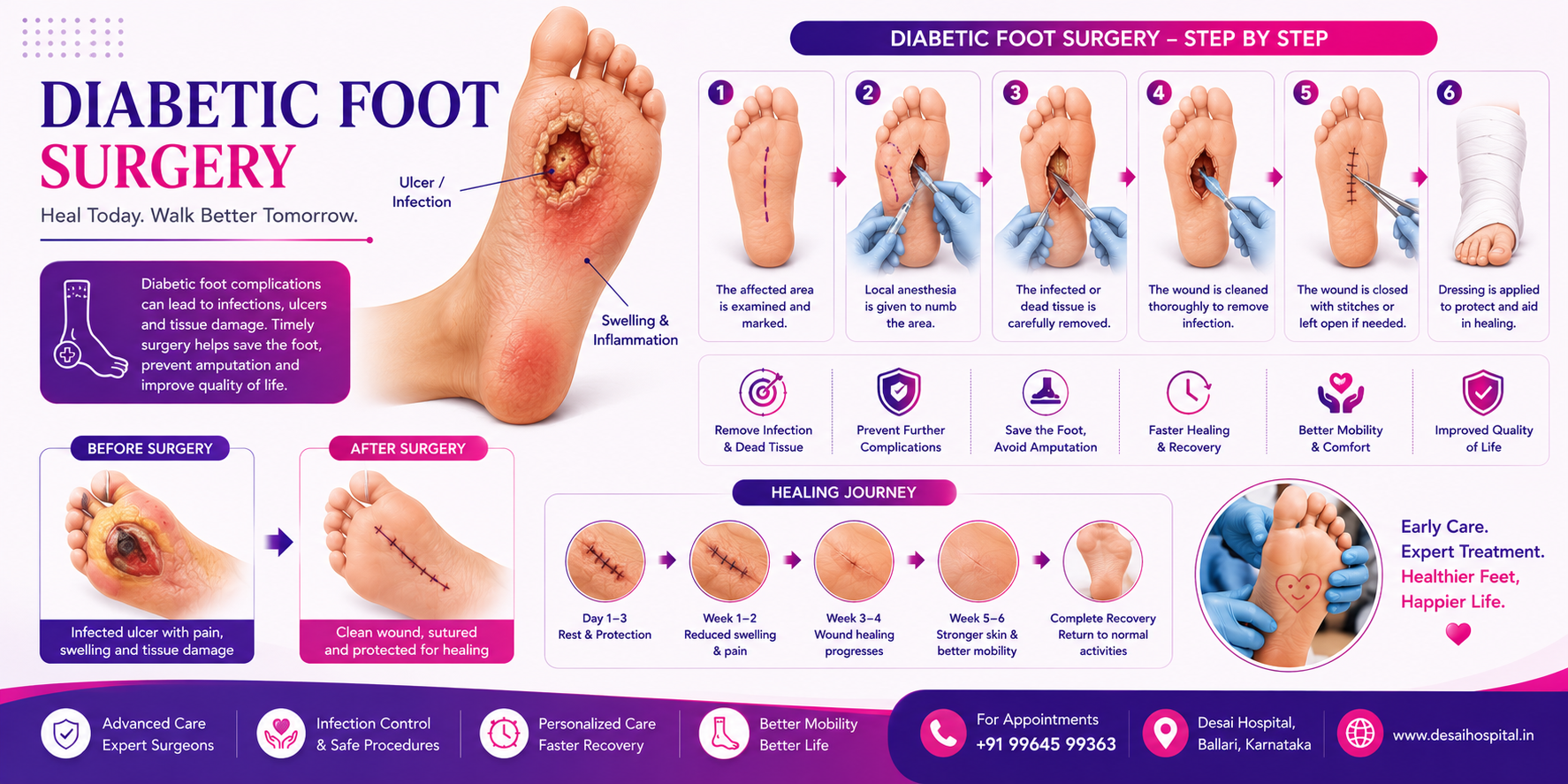 Diabetic Foot Surgery