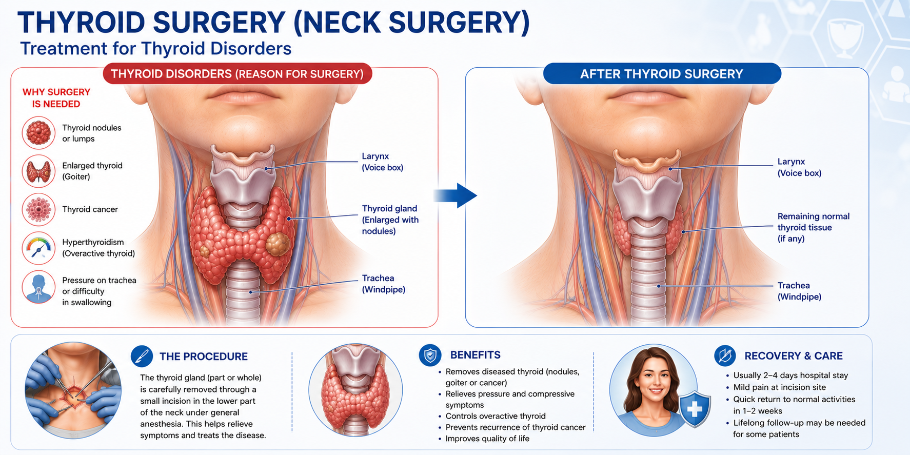 Thyroid Neck Surgery