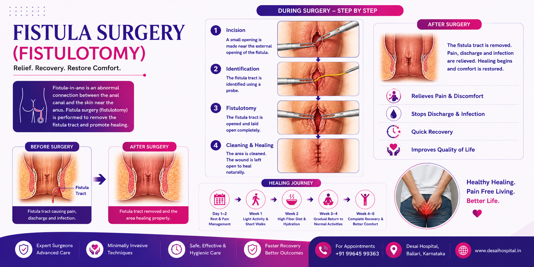 Fistula Surgery