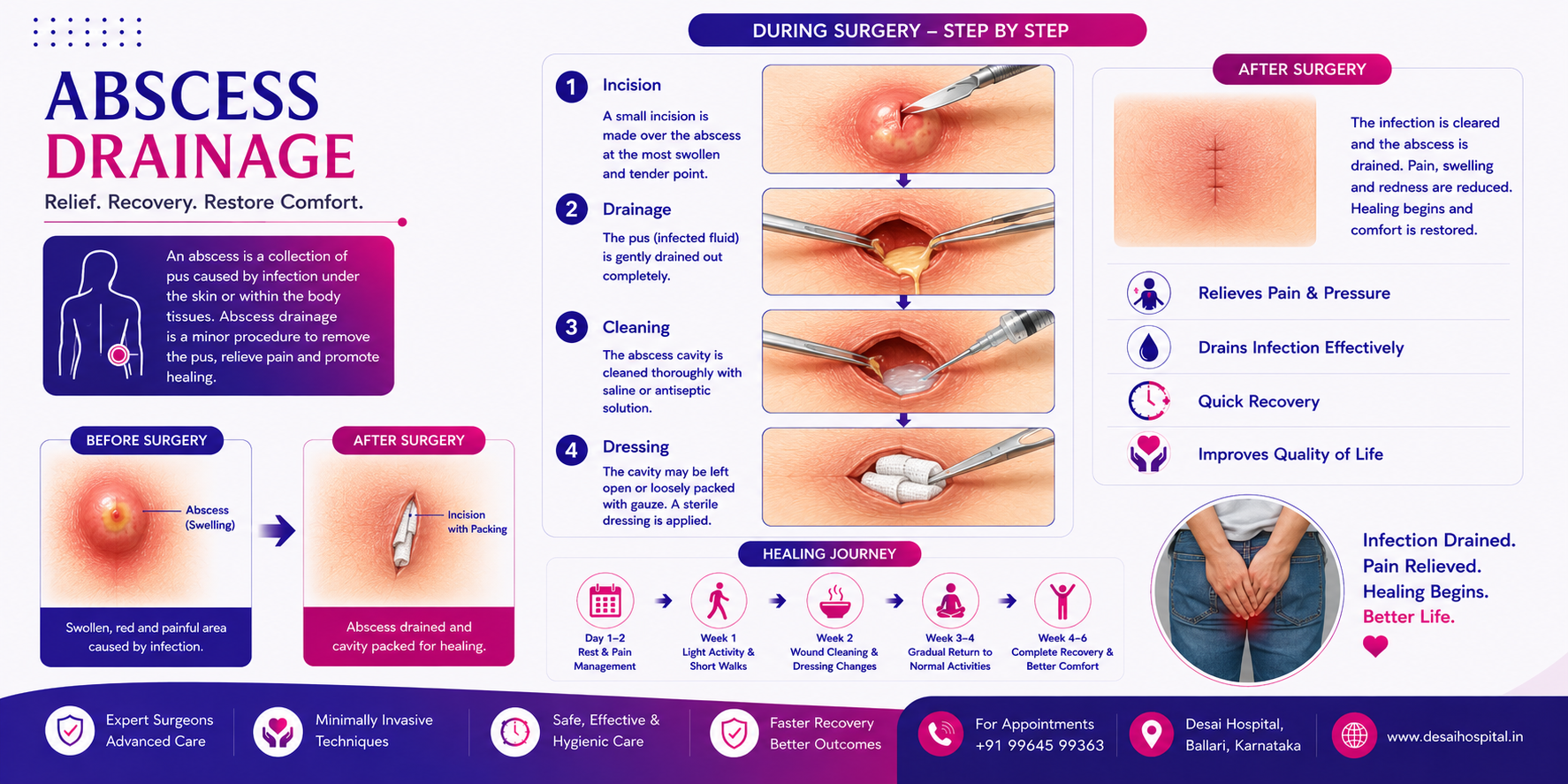 Abscess Drainage