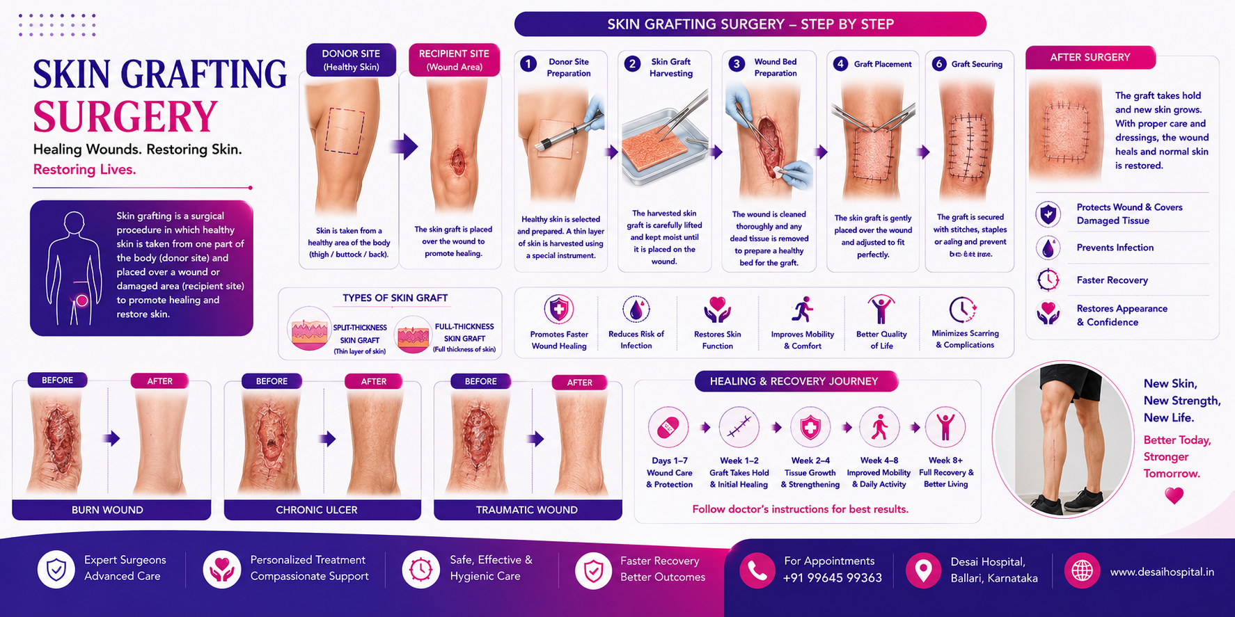 Skin Grafting Surgery