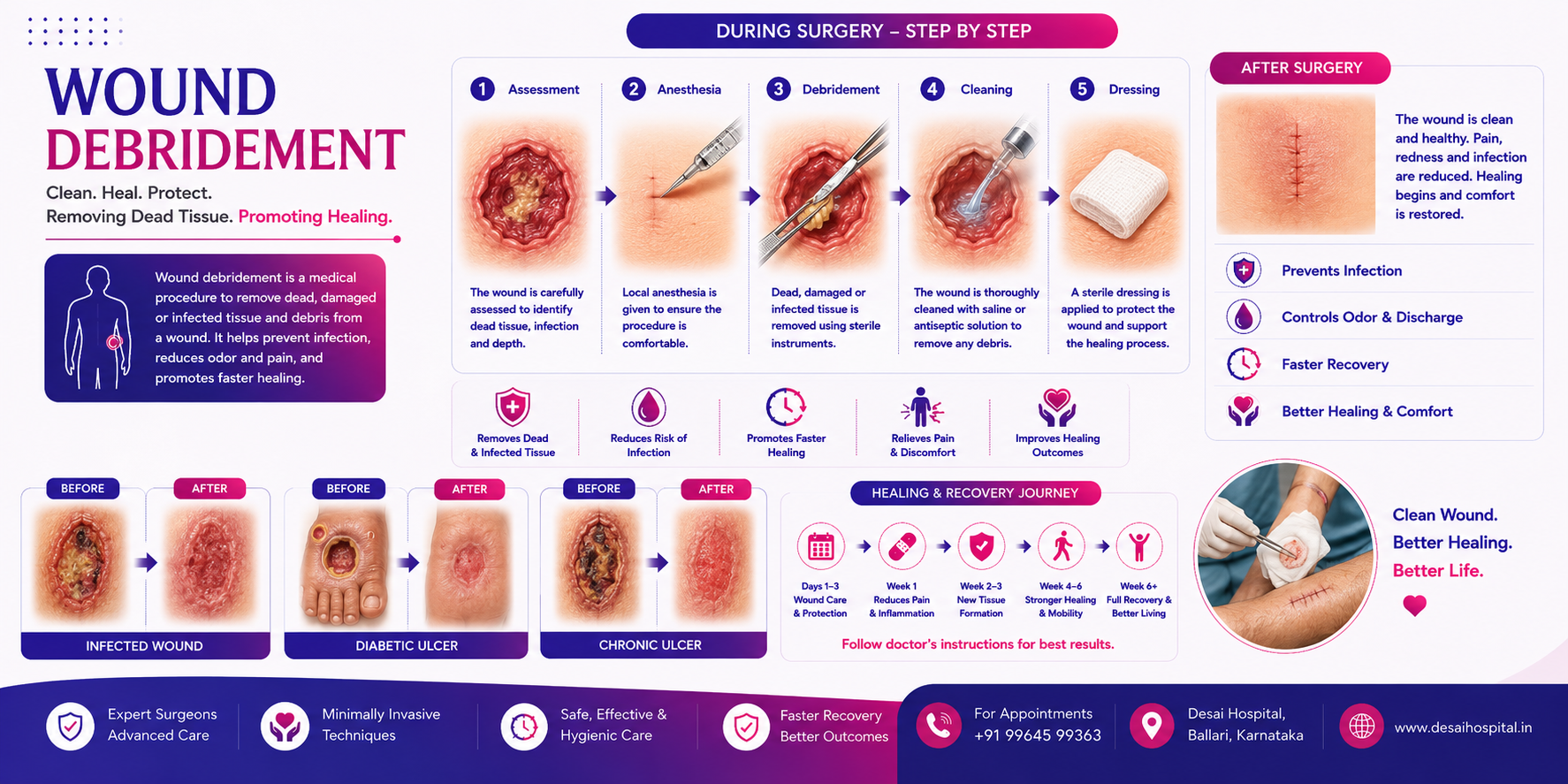 Wound Debridement