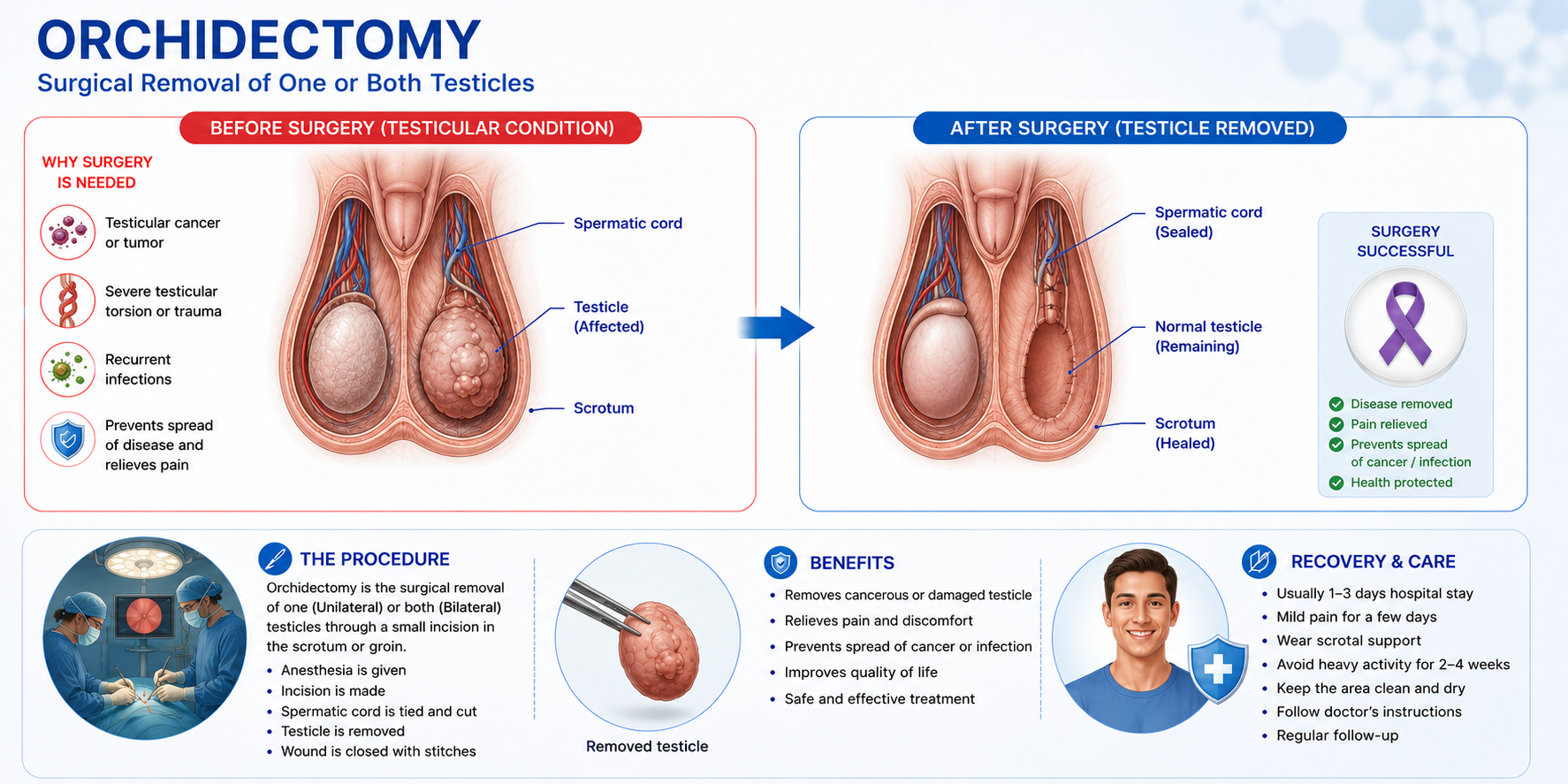Orchidectomy