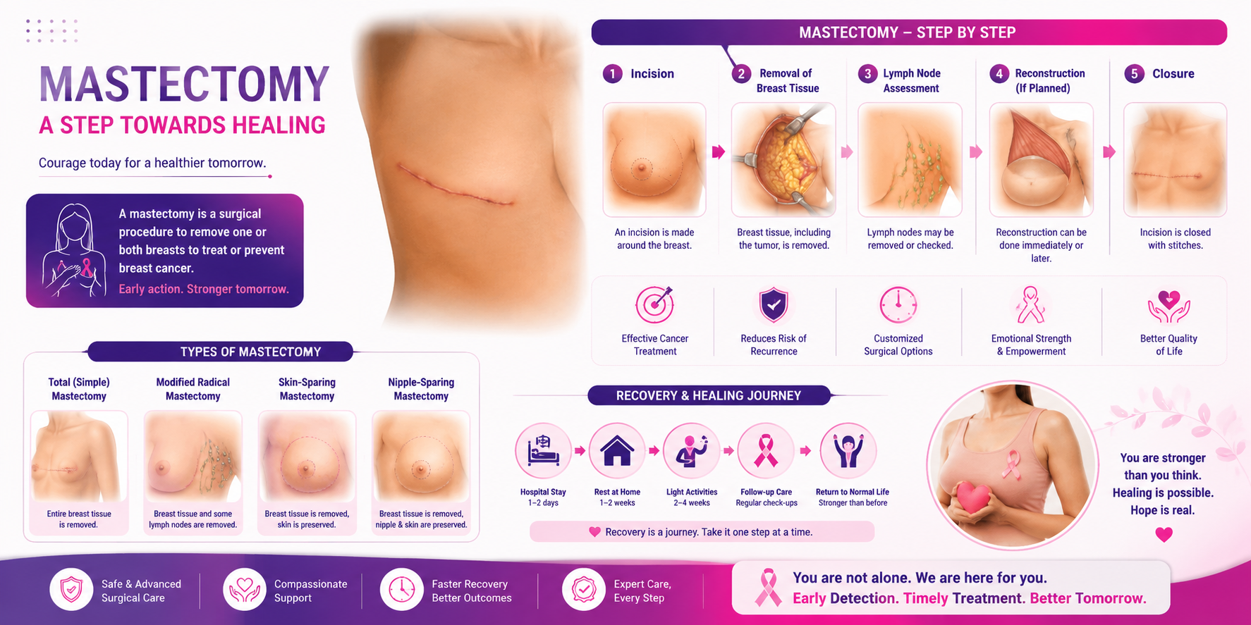 Mastectomy